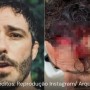 Ator Thiago Rodrigues é espancado e desmaia durante tentativa de assalto no Rio de Janeiro