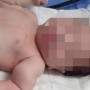 Bebê tem braço quebrado durante parto e país suspeitam de erro médico