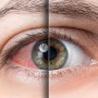 JULHO TURQUESA - Mês de conscientização e prevenção dos olhos secos
