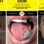 Anvisa discute mudanças nas imagens e mensagens em embalagens de cigarro